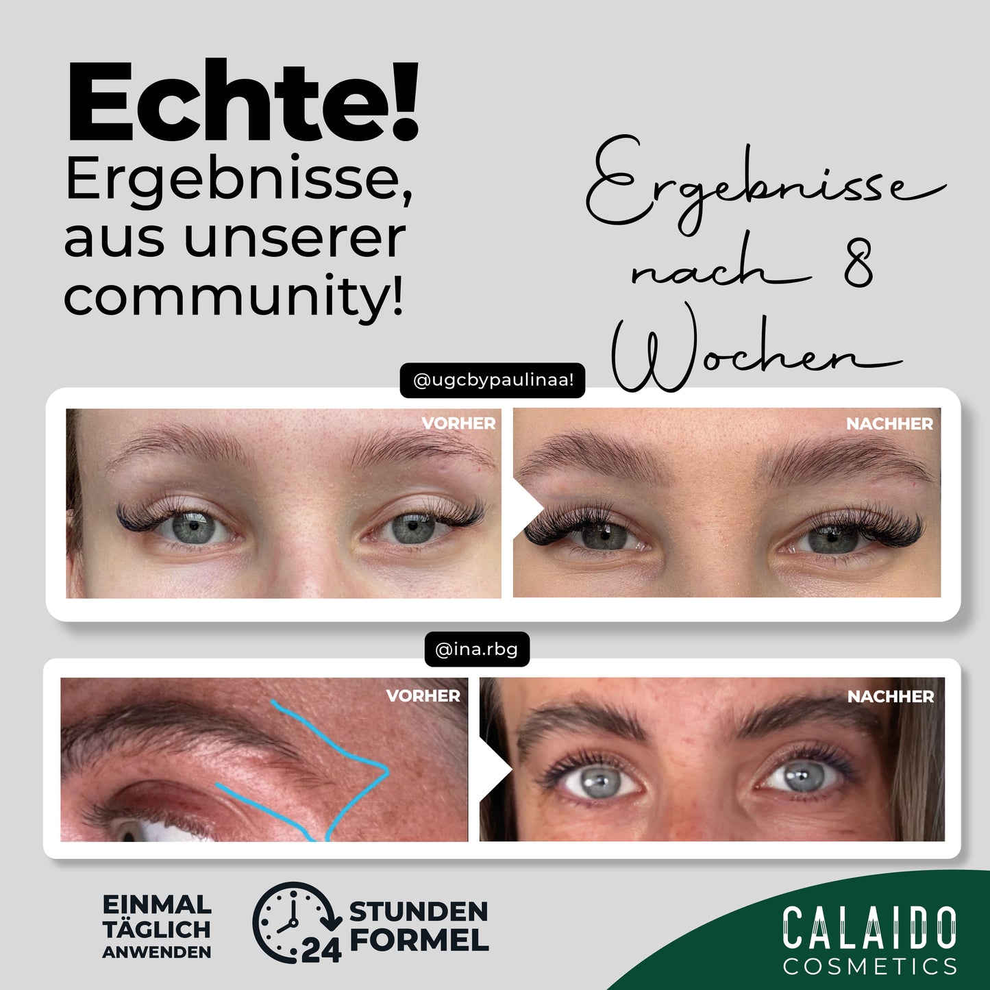 Calaido Eyebrow Serum – Fuller, Thicker Brows Naturally