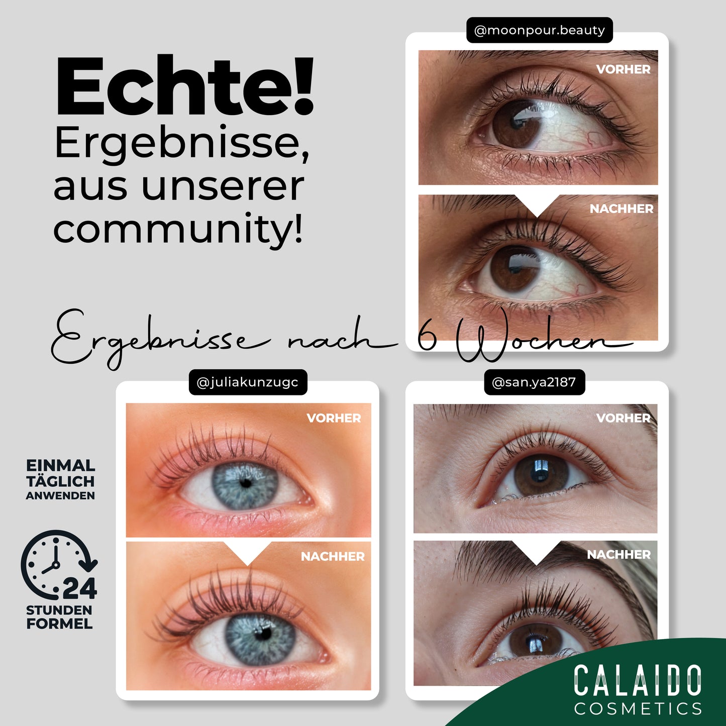 Calaido Eyelash Serum – Achieve Longer, Stronger, Fuller Lashes in Just 4 Weeks